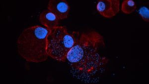4flourescence-image-4-40x